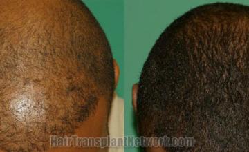 Front view - Before and after