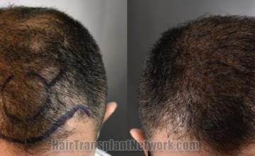 Front view - Before and after