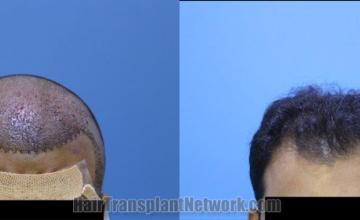 before and after result photographs