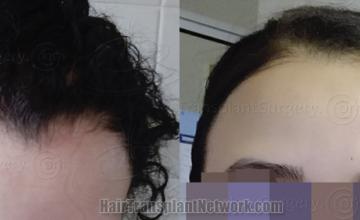 Front view - Before and after
