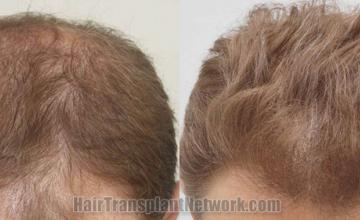 Front view - Before and after