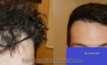 before and after result photographs