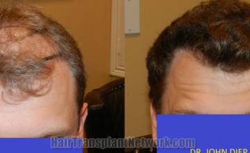 Front view - Before and after