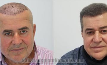 before and after result photographs