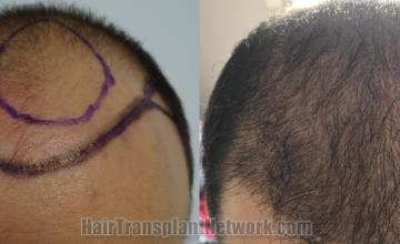 before and after result photographs