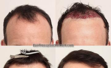 Front view - Before and after