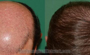 before and after result photographs