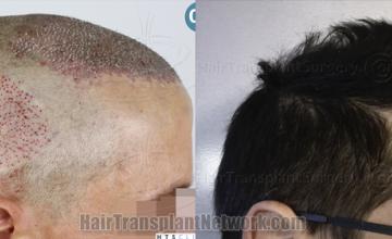  before and after result photographs