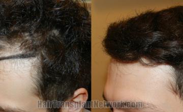  before and after result photographs