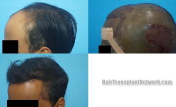  before and after photos