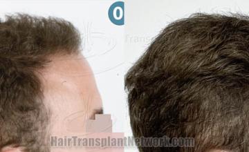  before and after result photographs