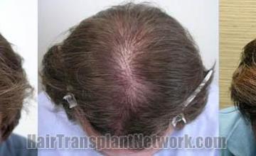 Top view - Before and after 