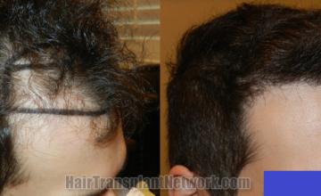  before and after result photographs