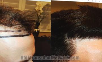  before and after result photographs