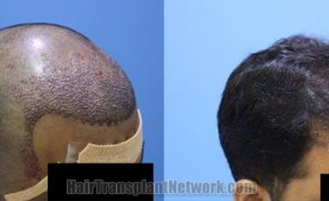  before and after result photographs