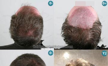  before and after photos