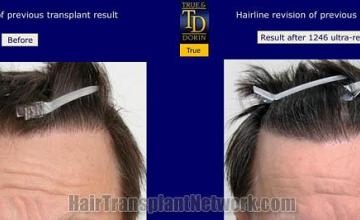 Front view - Before and after