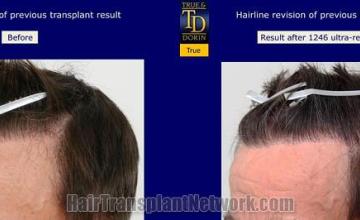  before and after photos