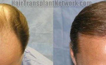 Before and after  - Top view