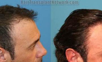  before and after pictures