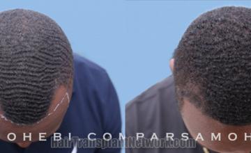 before and after result photographs