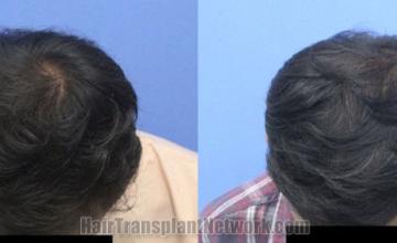  before and after result photographs