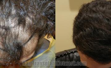  before and after result photographs