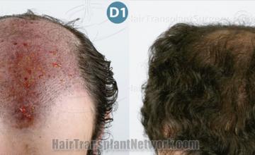 before and after result photographs