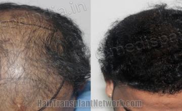 before and after result photographs