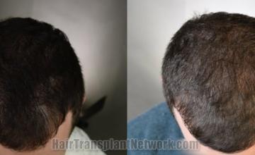  before and after result photographs