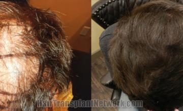  before and after result photographs
