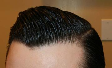 Left side close up