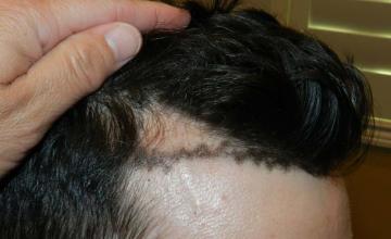 Right view of patient