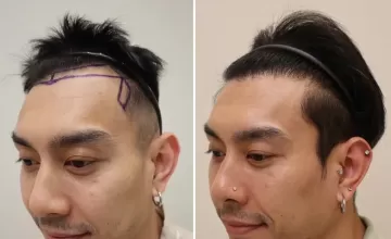 Front before and after