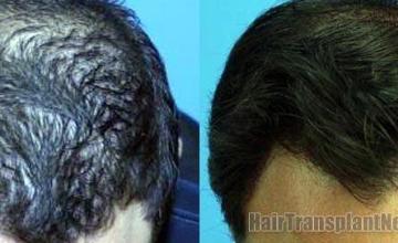  photos before and after pictures