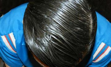 top of head after procedure