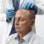What is Direct Hair Implantation (DHI)?
