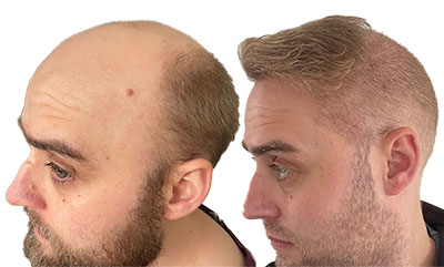 Before and after photo